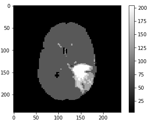 hdbscanminclust30tumorimage-slice077