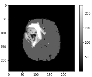 hdbscanminclust30tumorimage-slice084