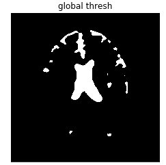 threshnormalbrain